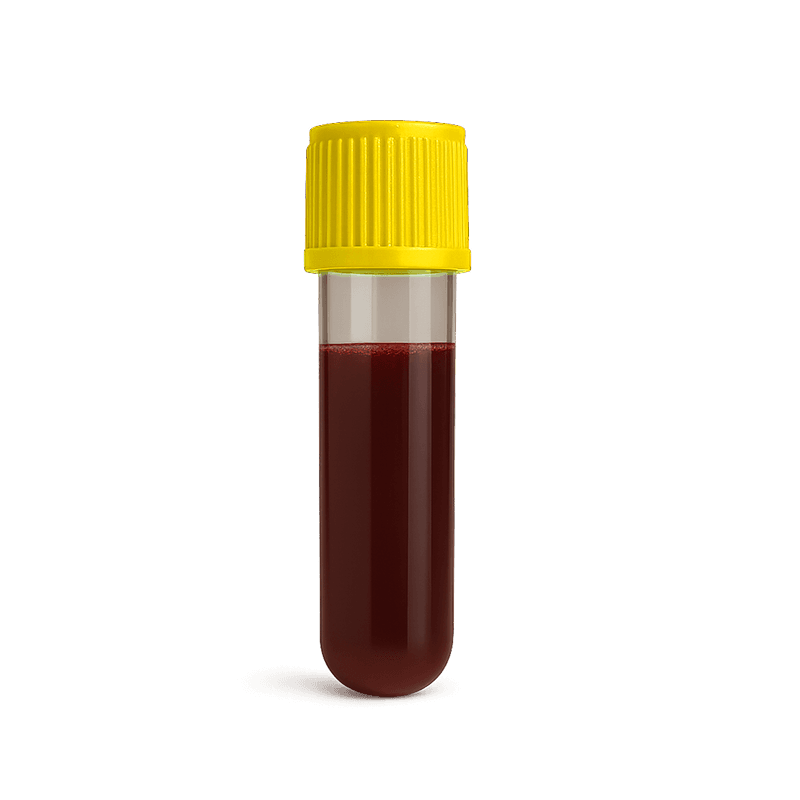 Vitamin D test