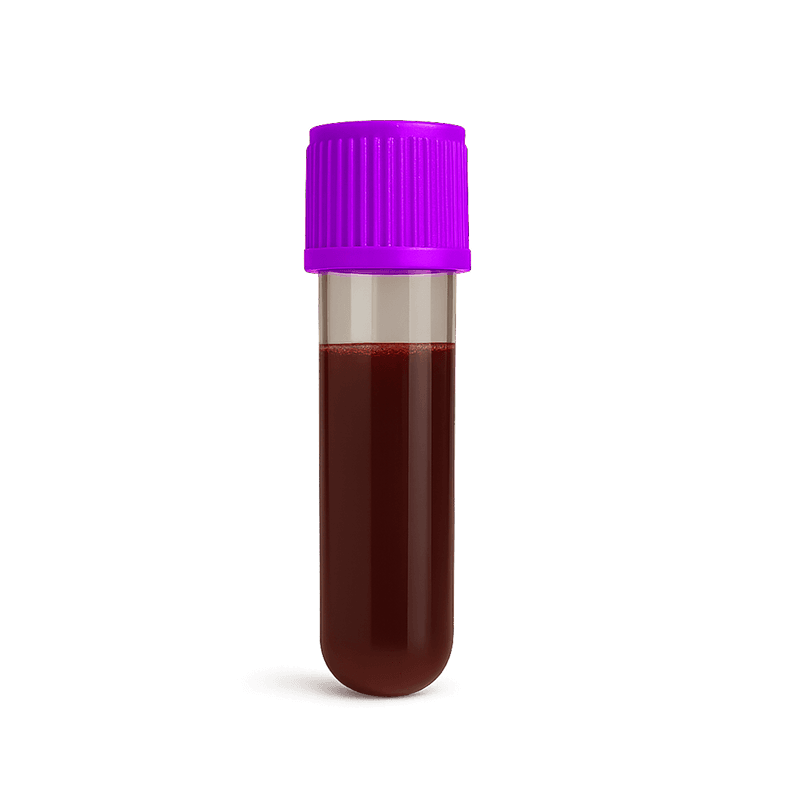 Lipid panel plus